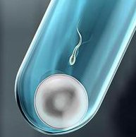 泰国教授！玛祖医生收费怎么样？附找玛祖做试管的价格