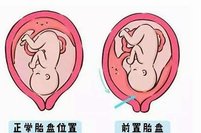 阜新细河区试管婴儿多少钱，阜新细河区试管婴儿多少钱啊