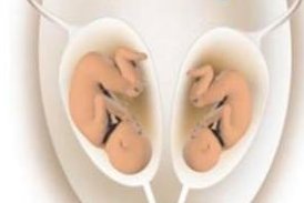 做了结扎手术可以在都匀市试管医院做试管婴儿吗？费用是多少